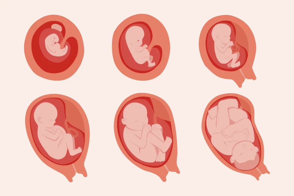 early fetal growth restriction